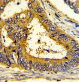 Immunohistochemistry (Formalin/PFA-fixed paraffin-embedded sections) - Anti-SCAP antibody (AB190103)