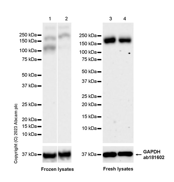 Western blot - Anti-SCAP antibody [EPR26242-60] - BSA and Azide free (AB308061), expandable thumbnail