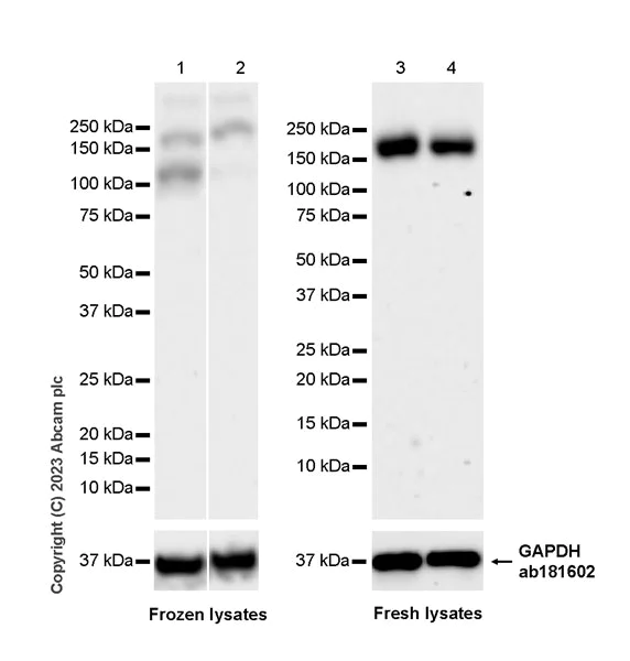 Western blot - Anti-SCAP antibody [EPR26242-60] - BSA and Azide free (AB308061)