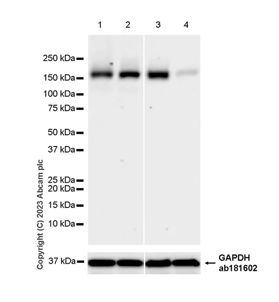 Western blot - Anti-SCAP antibody [EPR26242-60] - BSA and Azide free (AB308061)