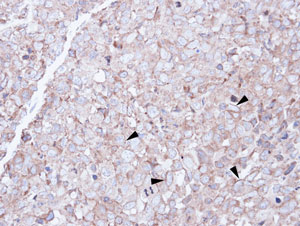 Immunohistochemistry (Formalin/PFA-fixed paraffin-embedded sections) - Anti-SCARA3 antibody (AB96205), expandable thumbnail