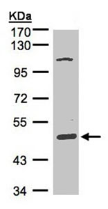 Western blot - Anti-SCARA3 antibody (AB96205), expandable thumbnail