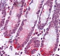 Immunohistochemistry (Formalin/PFA-fixed paraffin-embedded sections) - Anti-SCARA5 antibody (AB118894)
