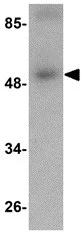 Western blot - Anti-SCARA5 antibody (AB118894)