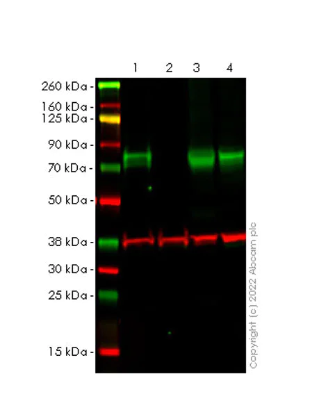 Western blot - Anti-Scavenging Receptor SR-BI antibody [25/CLA-1] (AB300632)