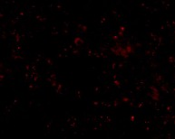 Immunocytochemistry/ Immunofluorescence - Anti-Scavenging Receptor SR-BI antibody (AB106572)