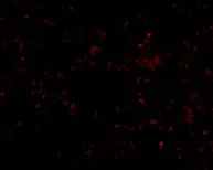 Immunocytochemistry/ Immunofluorescence - Anti-Scavenging Receptor SR-BI antibody (AB106572)