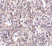 Immunohistochemistry (Formalin/PFA-fixed paraffin-embedded sections) - Anti-Scavenging Receptor SR-BI antibody (AB106572)