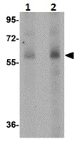 Western blot - Anti-Scavenging Receptor SR-BI antibody (AB106572)