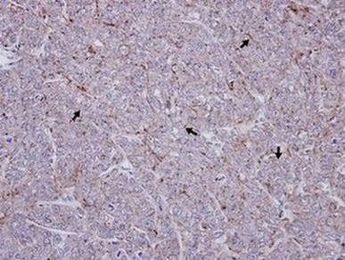 Immunohistochemistry (Formalin/PFA-fixed paraffin-embedded sections) - Anti-Scavenging Receptor SR-BI antibody (AB137829), expandable thumbnail