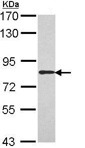 Western blot - Anti-Scavenging Receptor SR-BI antibody (AB137829), expandable thumbnail