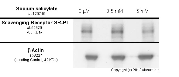 Functional Studies - Anti-Scavenging Receptor SR-BI antibody [EP1556Y] (AB52629)