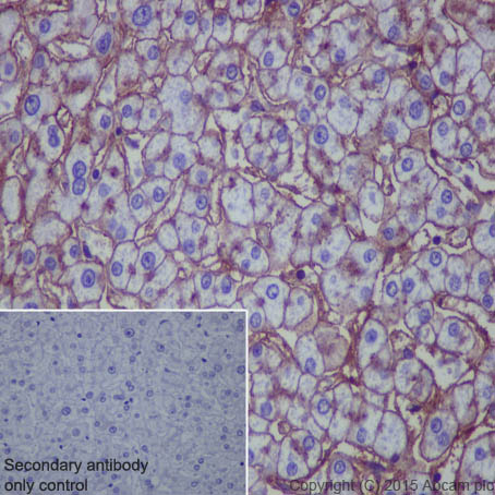 Immunohistochemistry (Formalin/PFA-fixed paraffin-embedded sections) - Anti-Scavenging Receptor SR-BI antibody [EP1556Y] (AB52629), expandable thumbnail