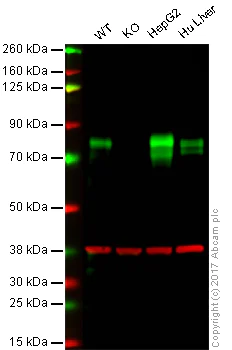 Western blot - Anti-Scavenging Receptor SR-BI antibody [EP1556Y] (AB52629)