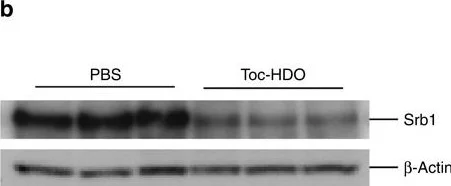 Western blot - Anti-Scavenging Receptor SR-BI antibody [EP1556Y] (AB52629)