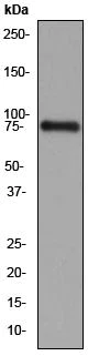 Western blot - Anti-Scavenging Receptor SR-BI antibody [EP1556Y] (AB52629)