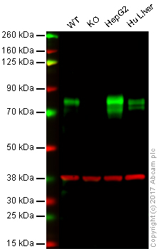 Western blot - Anti-Scavenging Receptor SR-BI antibody [EP1556Y] - Low endotoxin, Azide free (AB176238), expandable thumbnail