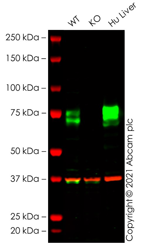 Western blot - Anti-Scavenging Receptor SR-BI antibody [EP1556Y] - Low endotoxin, Azide free (AB176238), expandable thumbnail