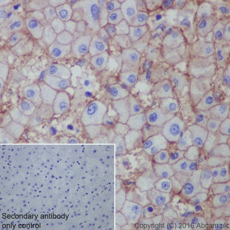 Immunohistochemistry (Formalin/PFA-fixed paraffin-embedded sections) - Anti-Scavenging Receptor SR-BI antibody [EPR20190] (AB217318), expandable thumbnail