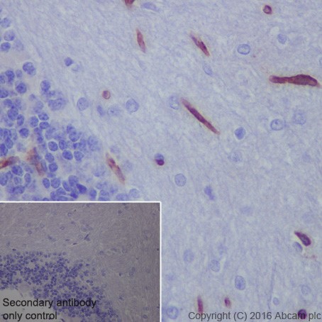 Immunohistochemistry (Formalin/PFA-fixed paraffin-embedded sections) - Anti-Scavenging Receptor SR-BI antibody [EPR20190] (ab217318), expandable thumbnail