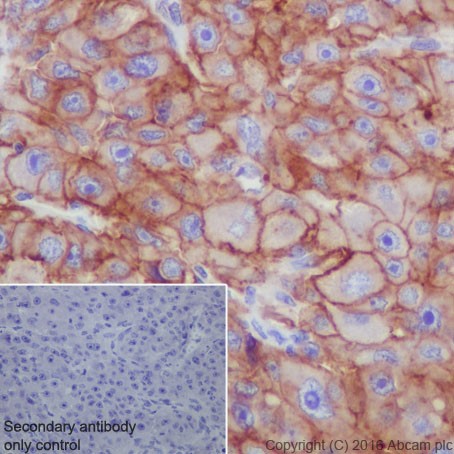 Immunohistochemistry (Formalin/PFA-fixed paraffin-embedded sections) - Anti-Scavenging Receptor SR-BI antibody [EPR20190] (ab217318), expandable thumbnail