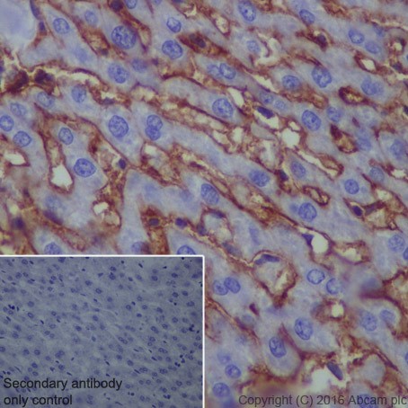 Immunohistochemistry (Formalin/PFA-fixed paraffin-embedded sections) - Anti-Scavenging Receptor SR-BI antibody [EPR20190] (ab217318), expandable thumbnail