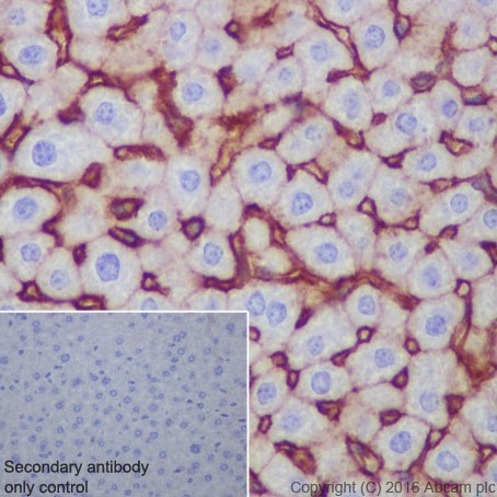 Immunohistochemistry (Formalin/PFA-fixed paraffin-embedded sections) - Anti-Scavenging Receptor SR-BI antibody [EPR20190] (ab217318), expandable thumbnail
