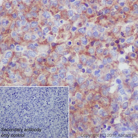 Immunohistochemistry (Formalin/PFA-fixed paraffin-embedded sections) - Anti-Scavenging Receptor SR-BI antibody [EPR20190] (ab217318), expandable thumbnail