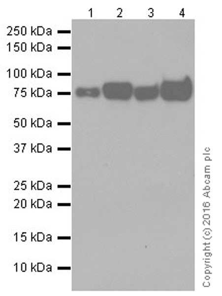 Western blot - Anti-Scavenging Receptor SR-BI antibody [EPR20190] (ab217318), expandable thumbnail