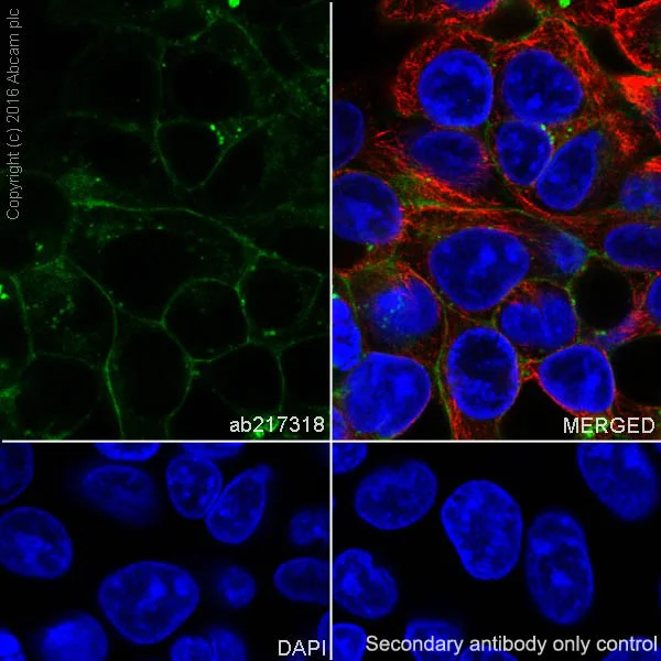 Immunocytochemistry/ Immunofluorescence - Anti-Scavenging Receptor SR-BI antibody [EPR20190] - Low endotoxin, Azide free (AB222931)