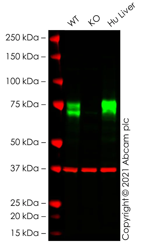 Western blot - Anti-Scavenging Receptor SR-BI antibody [EPR20190] - Low endotoxin, Azide free (AB222931)