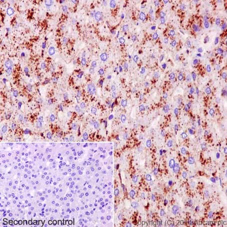 Immunohistochemistry (Formalin/PFA-fixed paraffin-embedded sections) - Anti-Scavenging Receptor SRB2 antibody [EPR12081] - BSA and Azide free (AB251221)