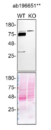 Western blot - Anti-Scavenging Receptor SRB2 antibody [EPR12081] - BSA and Azide free (AB251221)