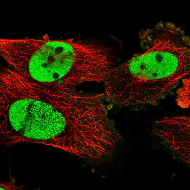 Immunocytochemistry/ Immunofluorescence - Anti-SCC112 antibody (AB122352)