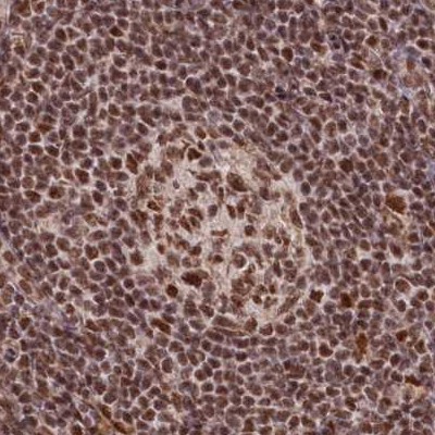 Immunohistochemistry (Formalin/PFA-fixed paraffin-embedded sections) - Anti-SCC112 antibody (AB122352), expandable thumbnail