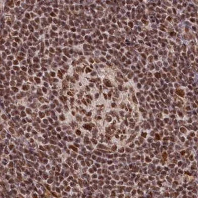 Immunohistochemistry (Formalin/PFA-fixed paraffin-embedded sections) - Anti-SCC112 antibody (AB122352)