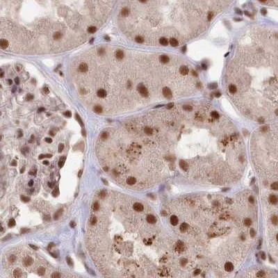 Immunohistochemistry (Formalin/PFA-fixed paraffin-embedded sections) - Anti-SCC112 antibody (AB122352)