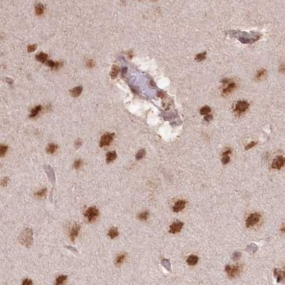Immunohistochemistry (Formalin/PFA-fixed paraffin-embedded sections) - Anti-SCC112 antibody (ab122352), expandable thumbnail