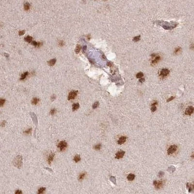 Immunohistochemistry (Formalin/PFA-fixed paraffin-embedded sections) - Anti-SCC112 antibody (AB122352)