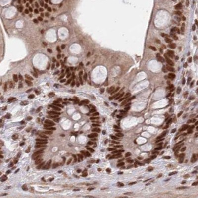 Immunohistochemistry (Formalin/PFA-fixed paraffin-embedded sections) - Anti-SCC112 antibody (AB122352), expandable thumbnail