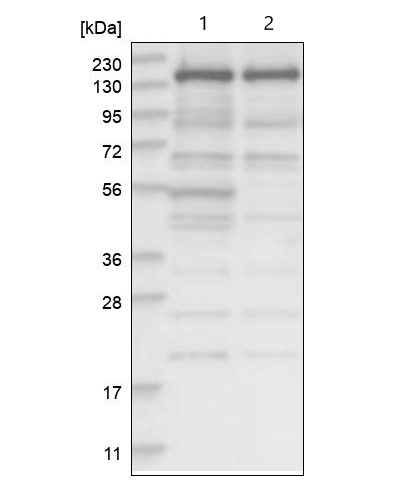 Western blot - Anti-SCC112 antibody (AB122352), expandable thumbnail