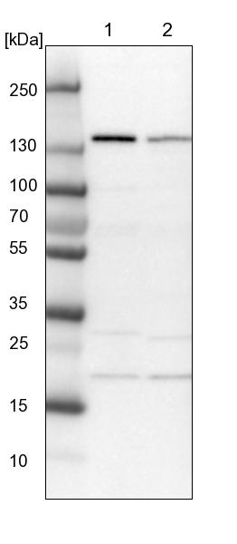 Western blot - Anti-SCC112 antibody (AB122352), expandable thumbnail