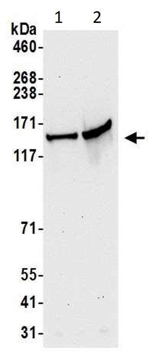 Western blot - Anti-SCC112 antibody (AB17961)