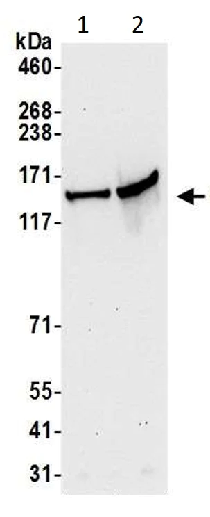 Western blot - Anti-SCC112 antibody (AB17961)