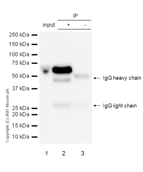 Immunoprecipitation - Anti-Scc4 antibody [EPR14390] (AB183033)