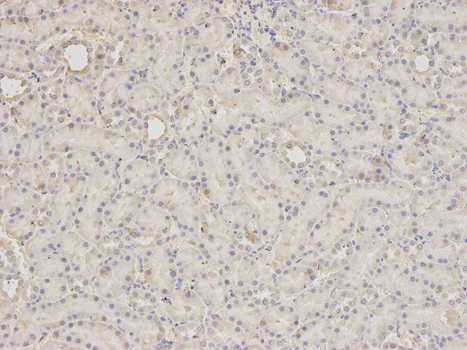 Immunohistochemistry (Formalin/PFA-fixed paraffin-embedded sections) - Anti-SCCPDH antibody (AB185709)