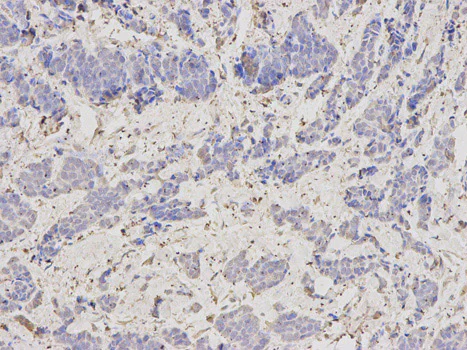 Immunohistochemistry (Formalin/PFA-fixed paraffin-embedded sections) - Anti-SCCPDH antibody (AB185709)