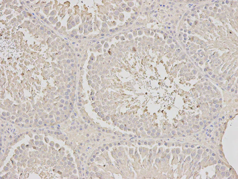 Immunohistochemistry (Formalin/PFA-fixed paraffin-embedded sections) - Anti-SCCPDH antibody (AB185709)