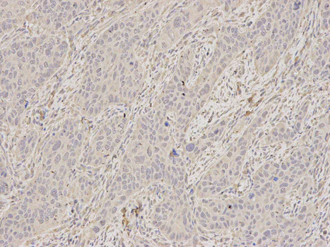 Immunohistochemistry (Formalin/PFA-fixed paraffin-embedded sections) - Anti-SCCPDH antibody (AB185709)