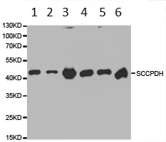Western blot - Anti-SCCPDH antibody (AB185709)